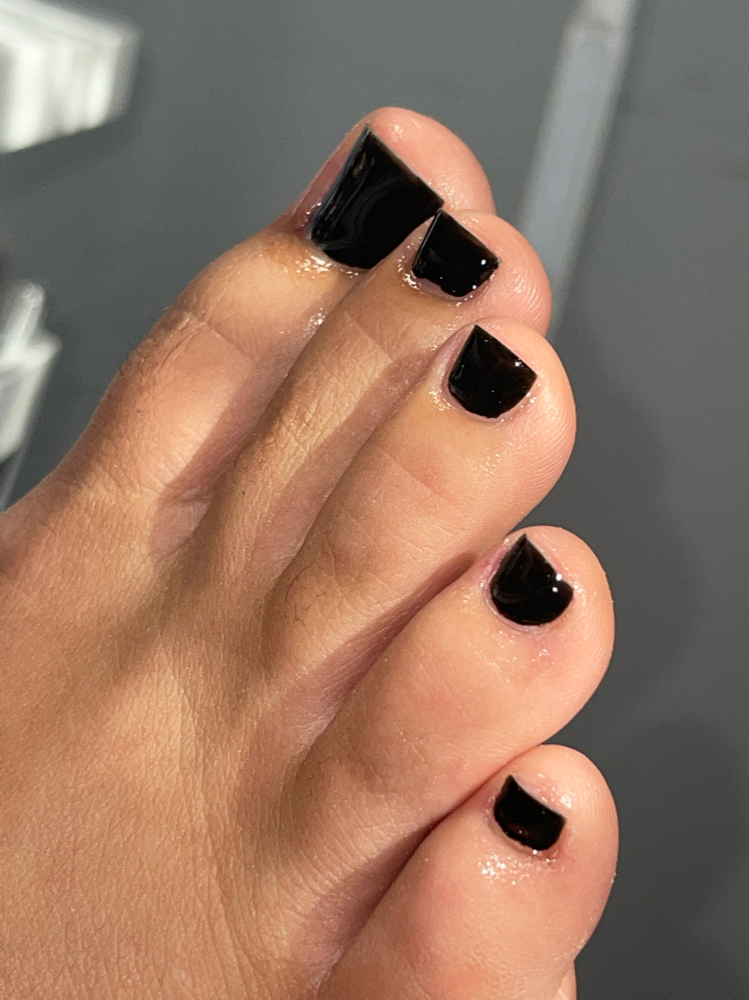 Gel Toes