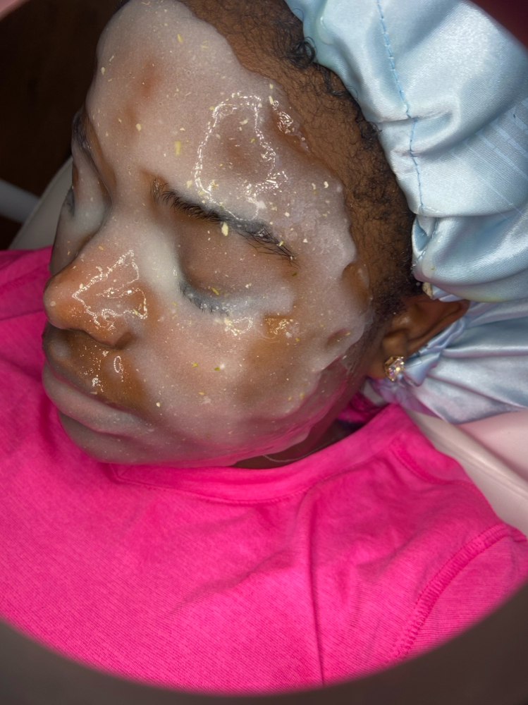 Hydra-Facial