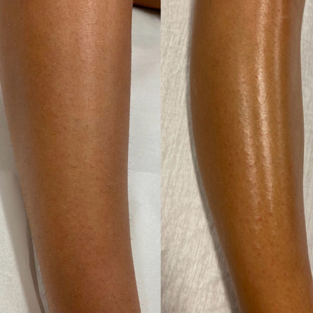 Half Leg Wax at Kneaded Luxury Beauty Bar in Huntington Valley, PA
