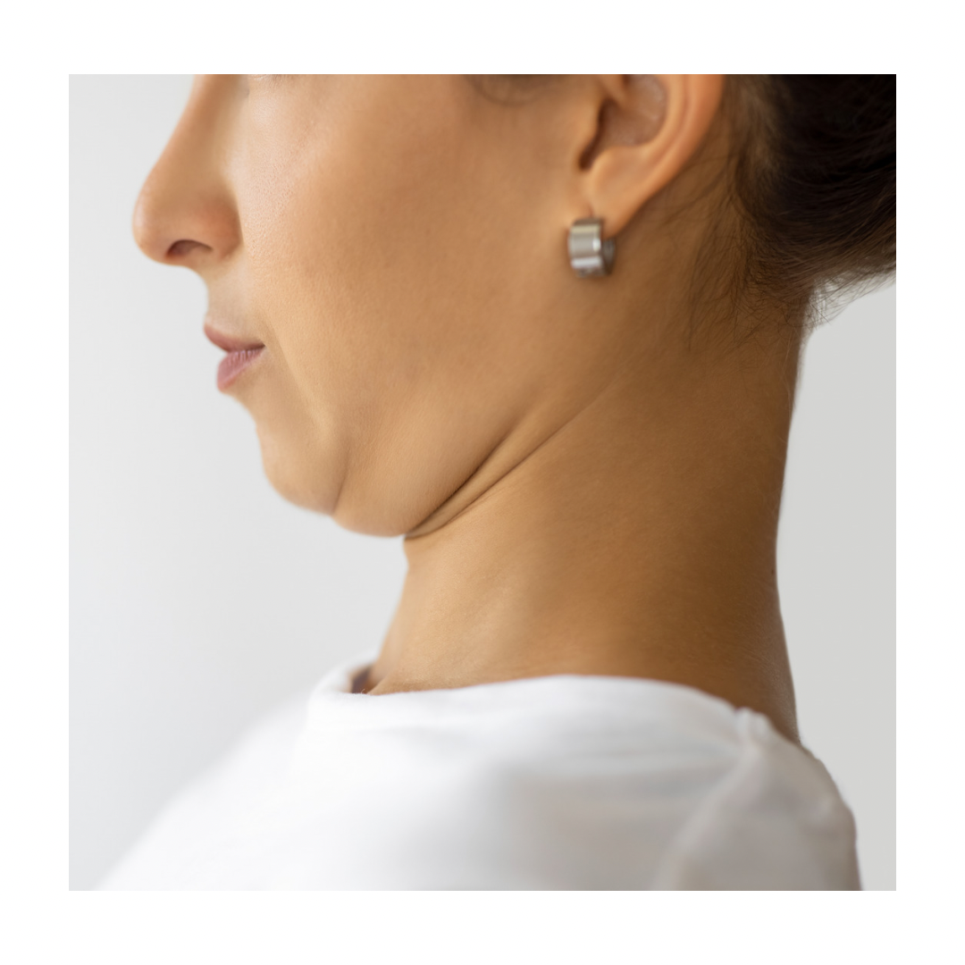 Double Chin Treatment