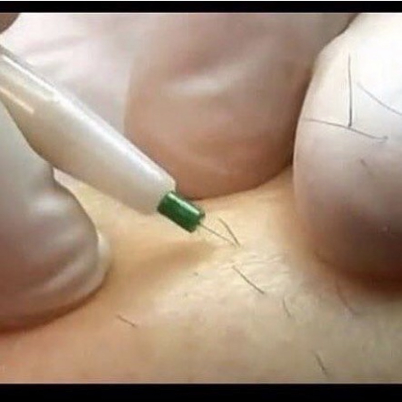 Electrolysis