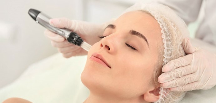 Microneedling w/o LED - Face Only