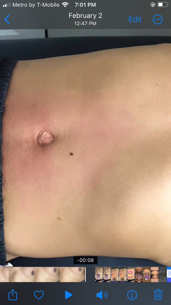 Stomach Wax