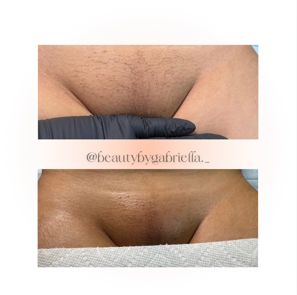 Brazilian (includes Butt Strip)