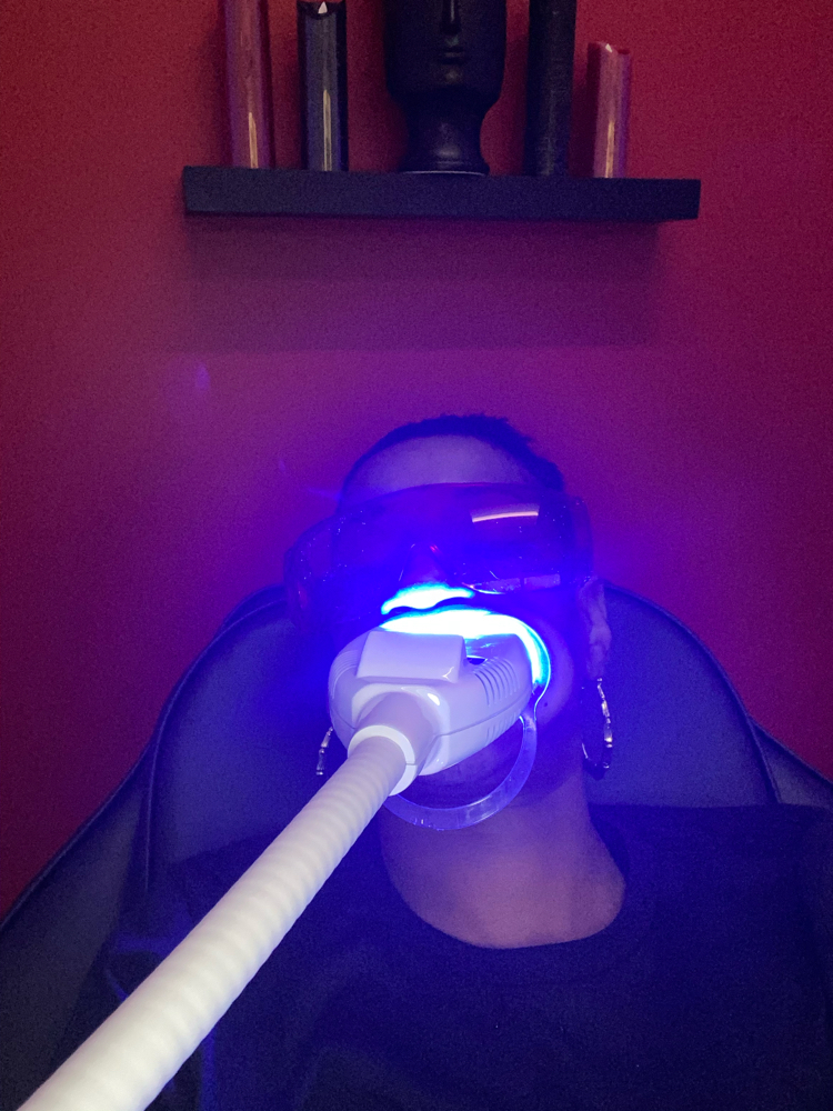 TEETH WHITENING IN-SPA 60 MIN