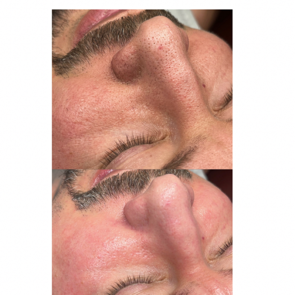 Deluxe Glow at Deluxe Glow in Clifton, NJ