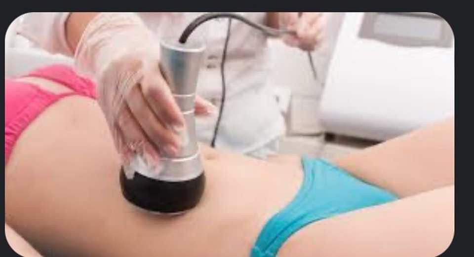 Laser Cellulite Reduction