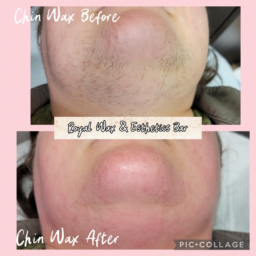 Chin Wax