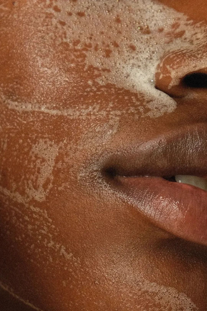 Chemical Peel- Add on