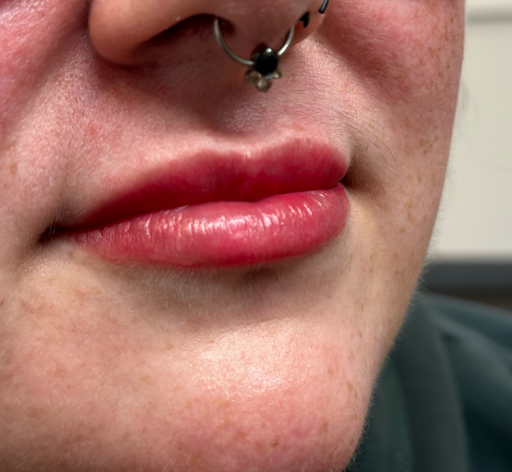 Lip Blushing