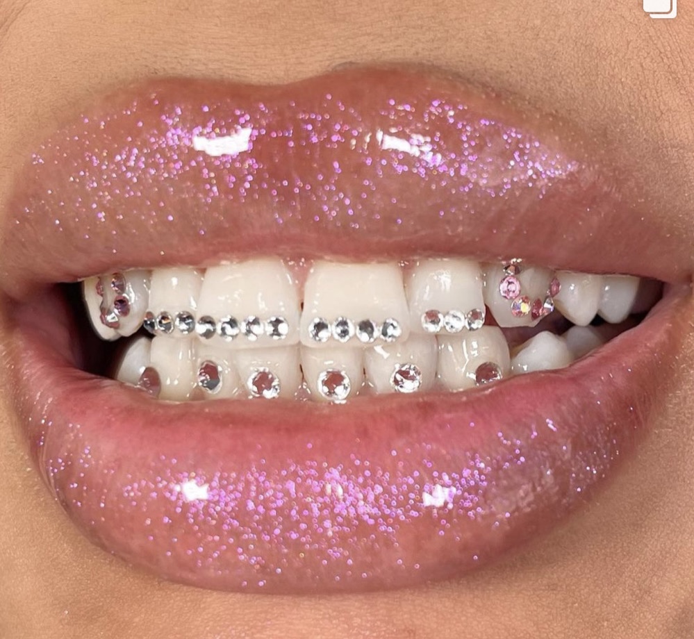 Custom Grill Design 10plus Crystals