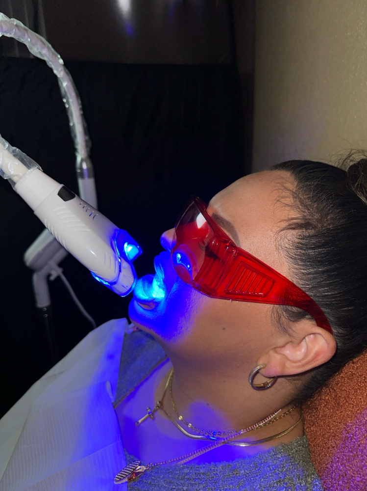 Teeth Whitening