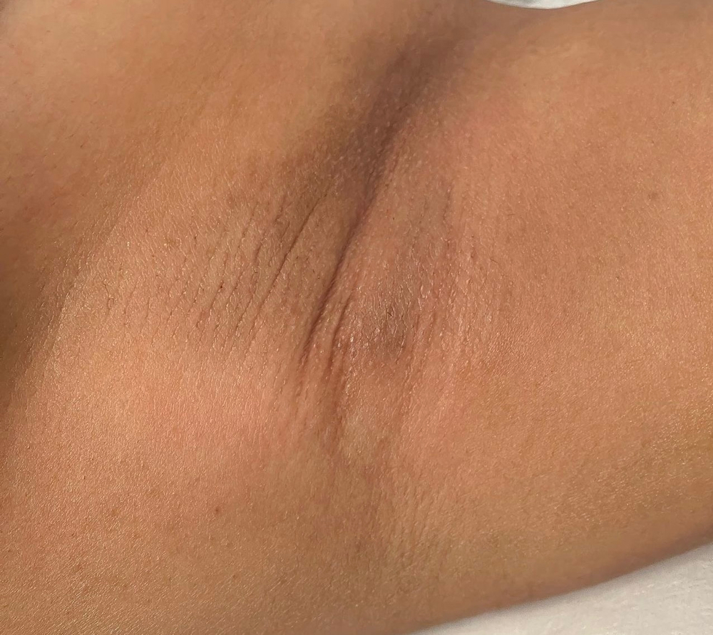 Armpit Wax