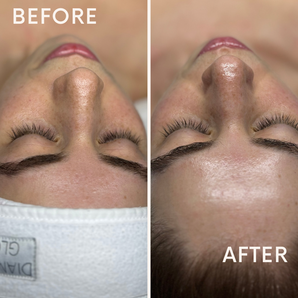 Diamond Glow Facial