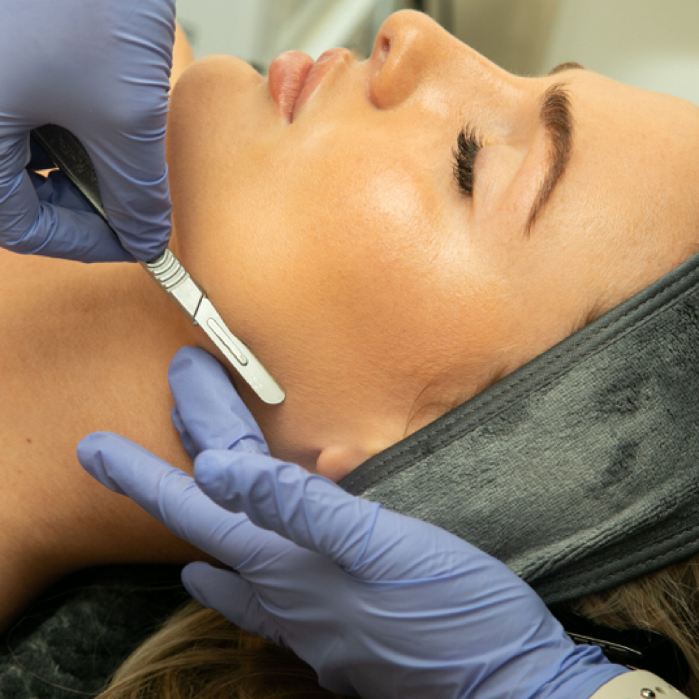 Dermaplane + Glass Skin Peel & LED at Glō Skincare LLC in Chicago, IL