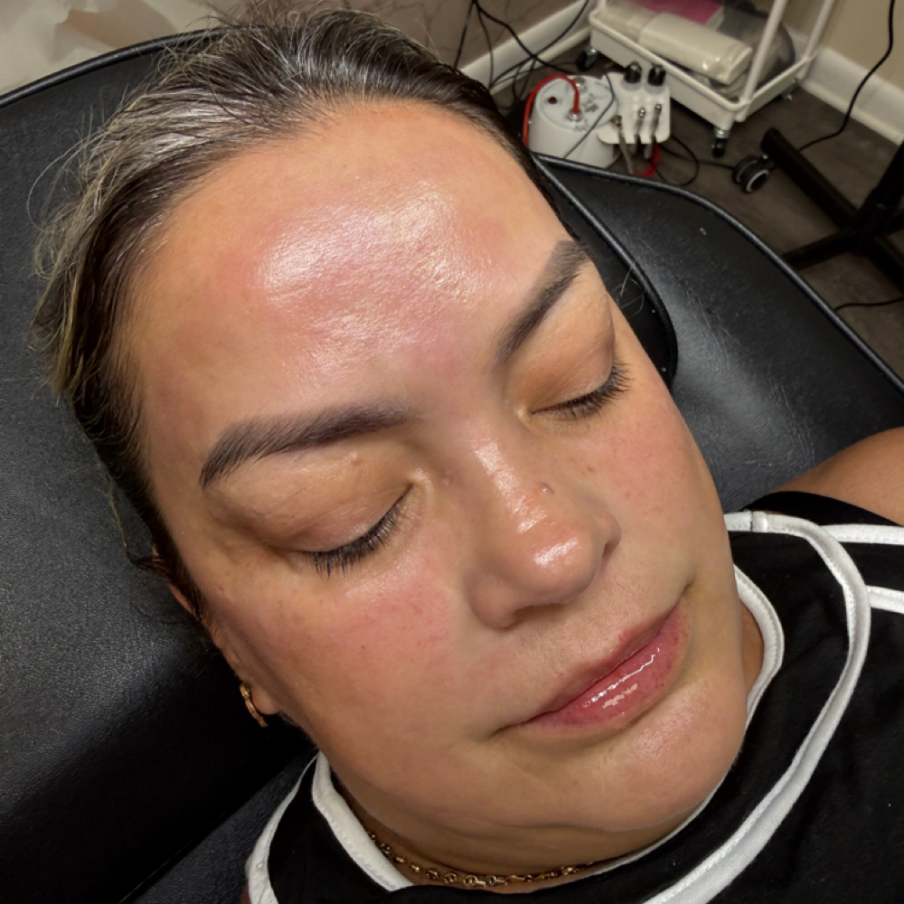 Tratamiento Plasma + Pink Glow at Mjzlamouresthetic in Brandon, FL