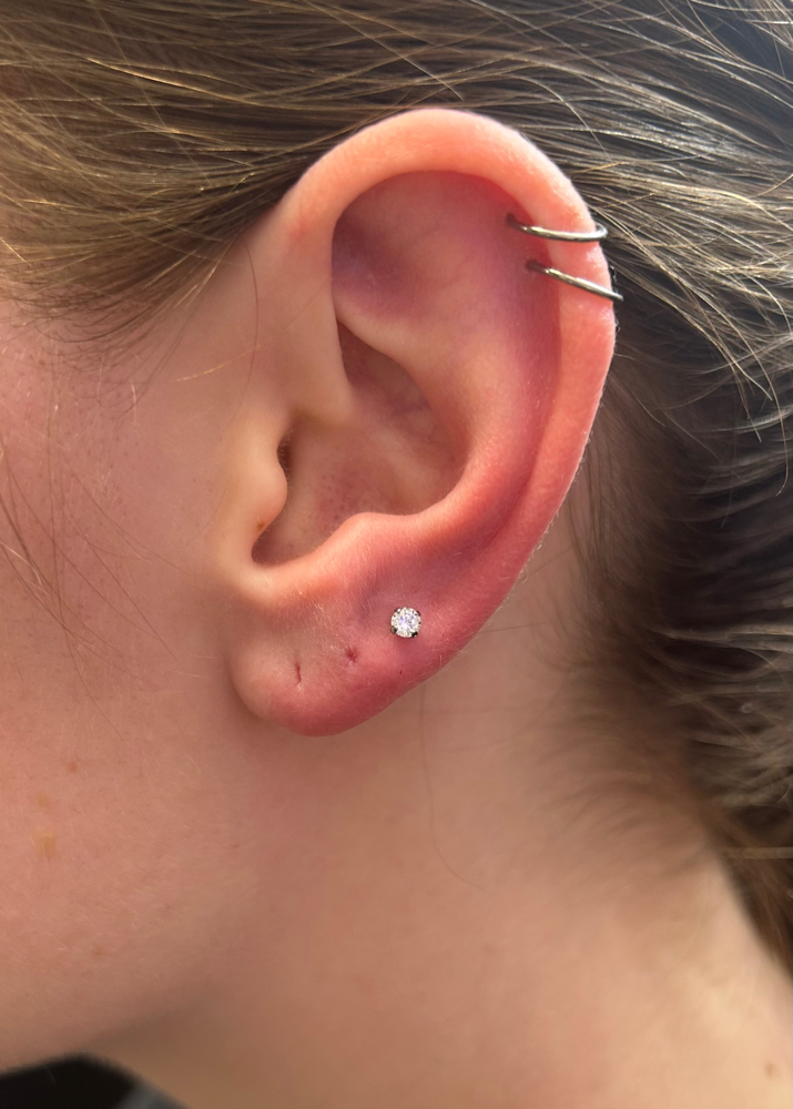 Single Earlobe