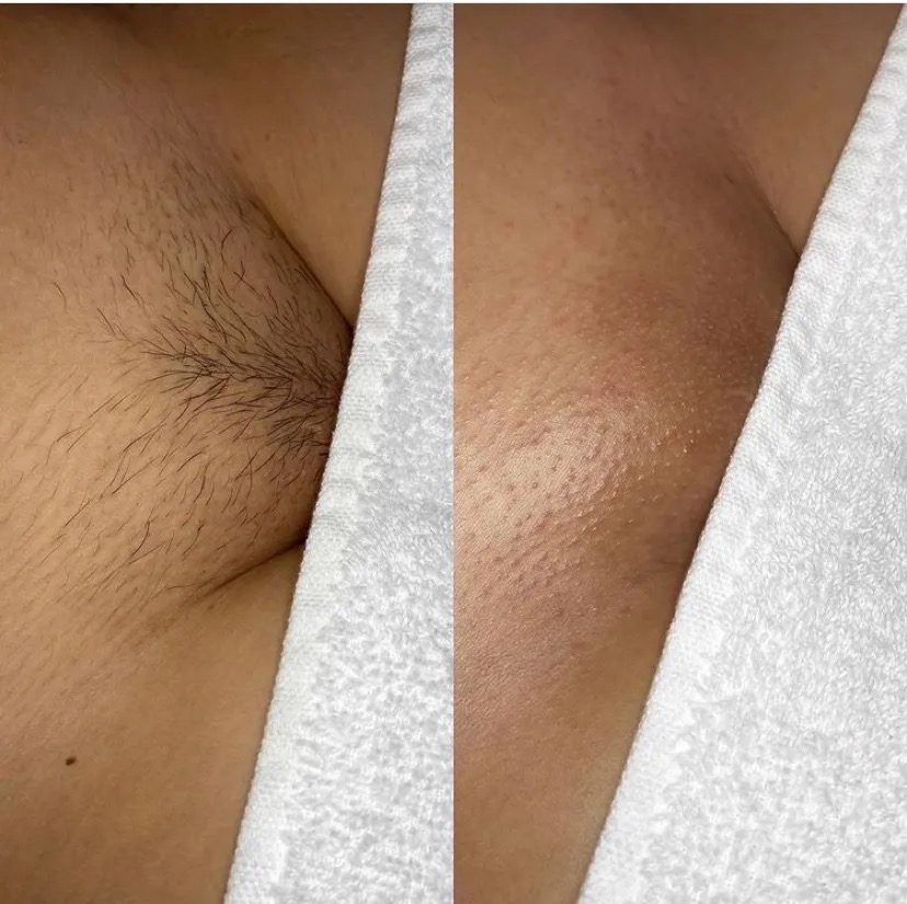 Bare With It Brazilian Wax