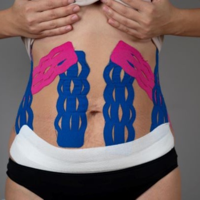 Body Post Op Treatment at Flavia Guimarães  Wellness & Beauty in Millbrae, CA