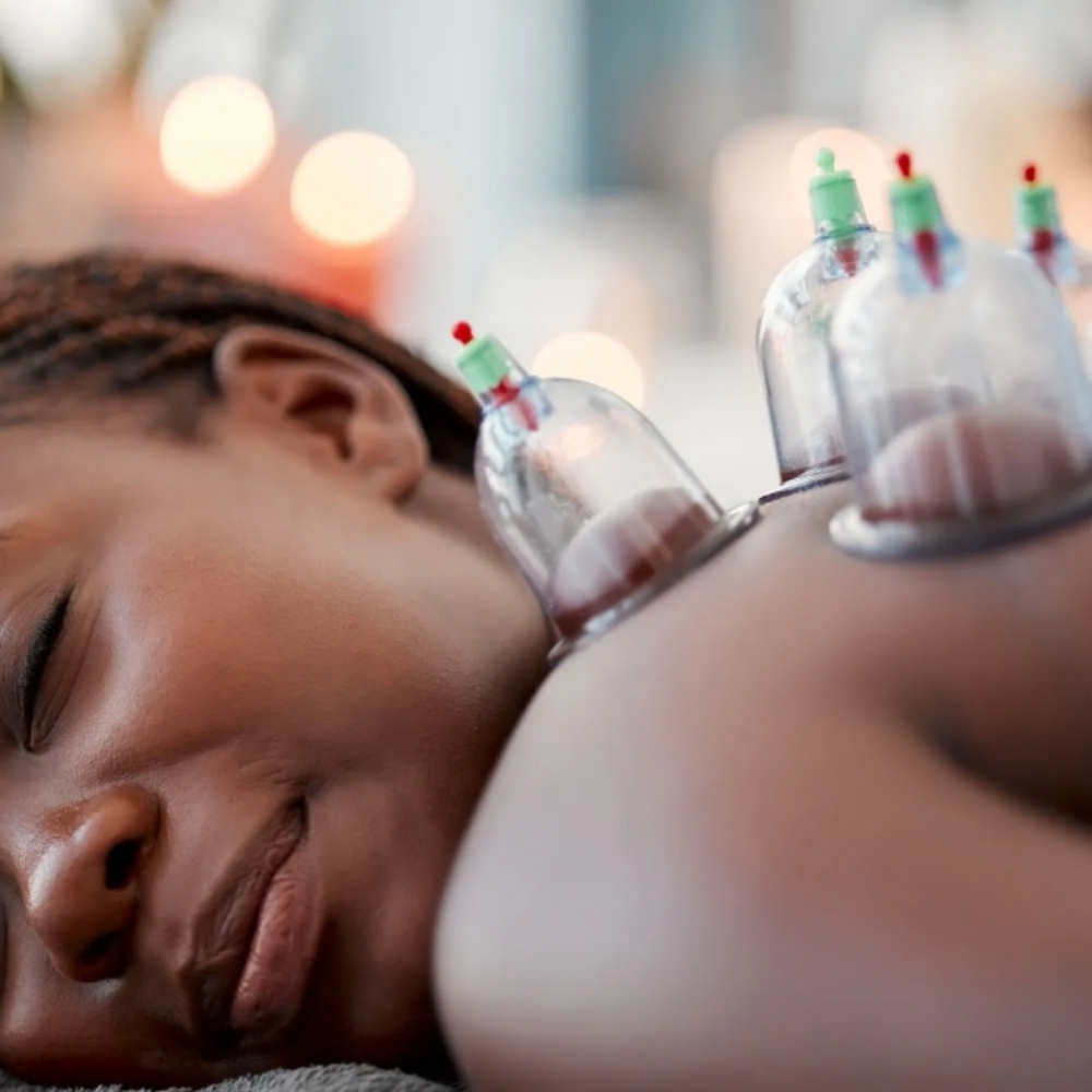 Cupping Therapy at Houda Holistics in North Brunswick, NJ