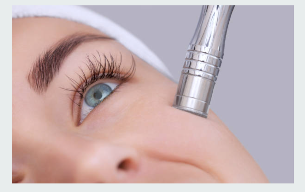 Microdermabrasion Facial