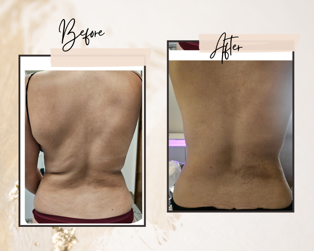 Body Sculpting at Vicky's Spa & Skincare LLC in Federal Way, WA