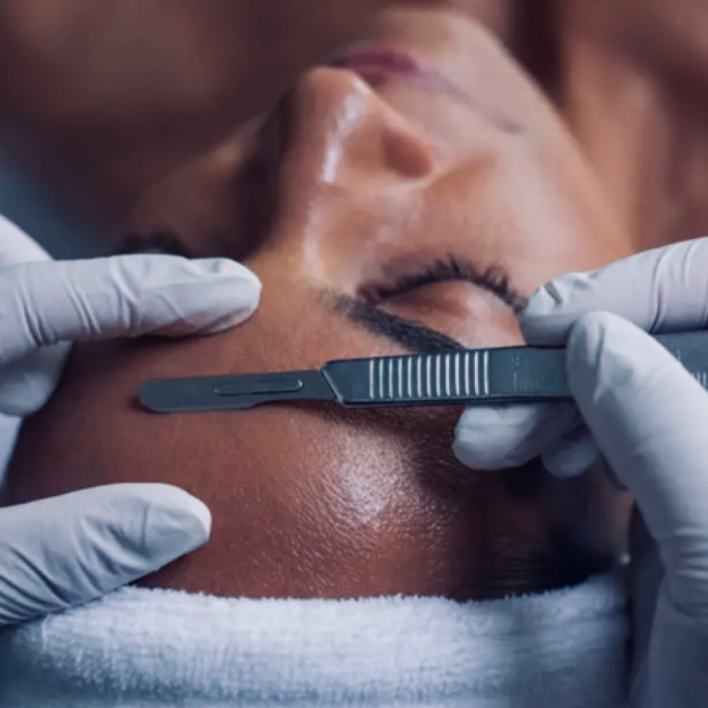 Dermaplane Facial at Skin Studio by D in Minneola, FL