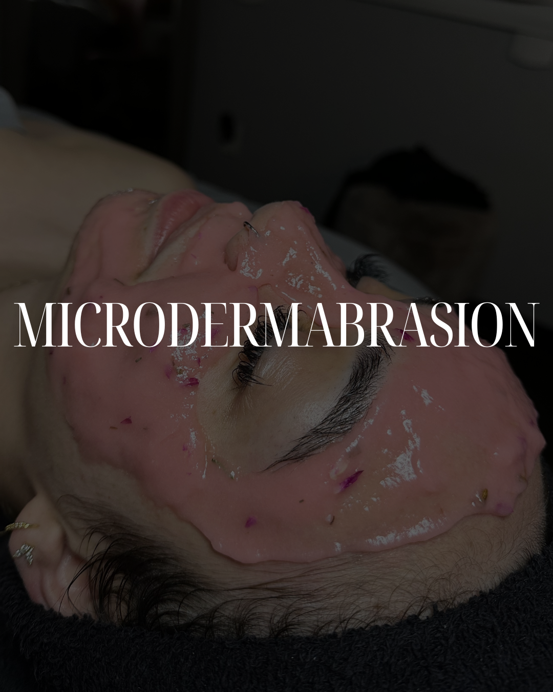 Microdermabrasion