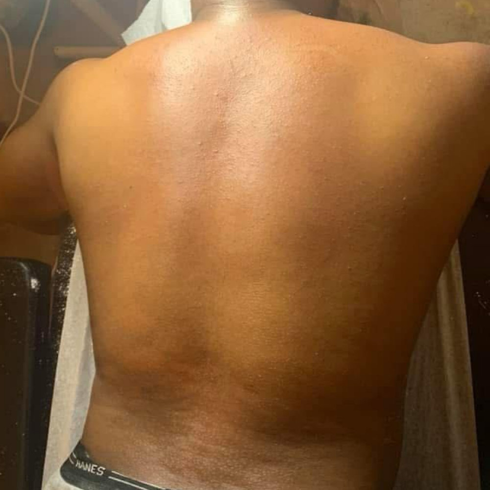 Back Waxing at Your Local Coochie Waxer in Louisville, KY