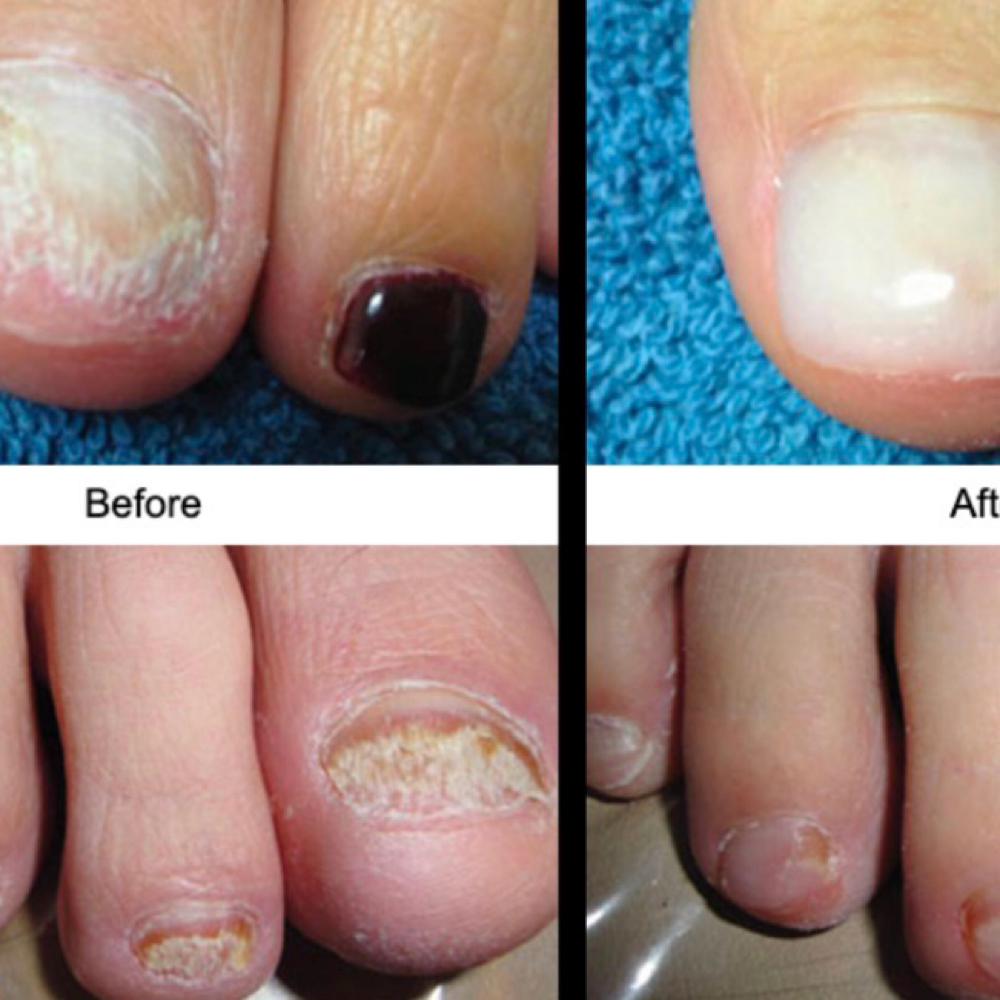 Fungal Cleaning Only at Selis.Studio in Riverside, IL