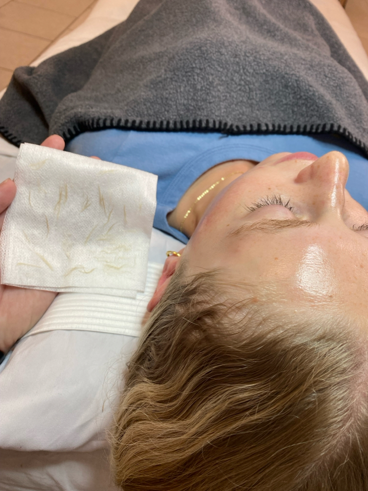 Dermaplane Facial