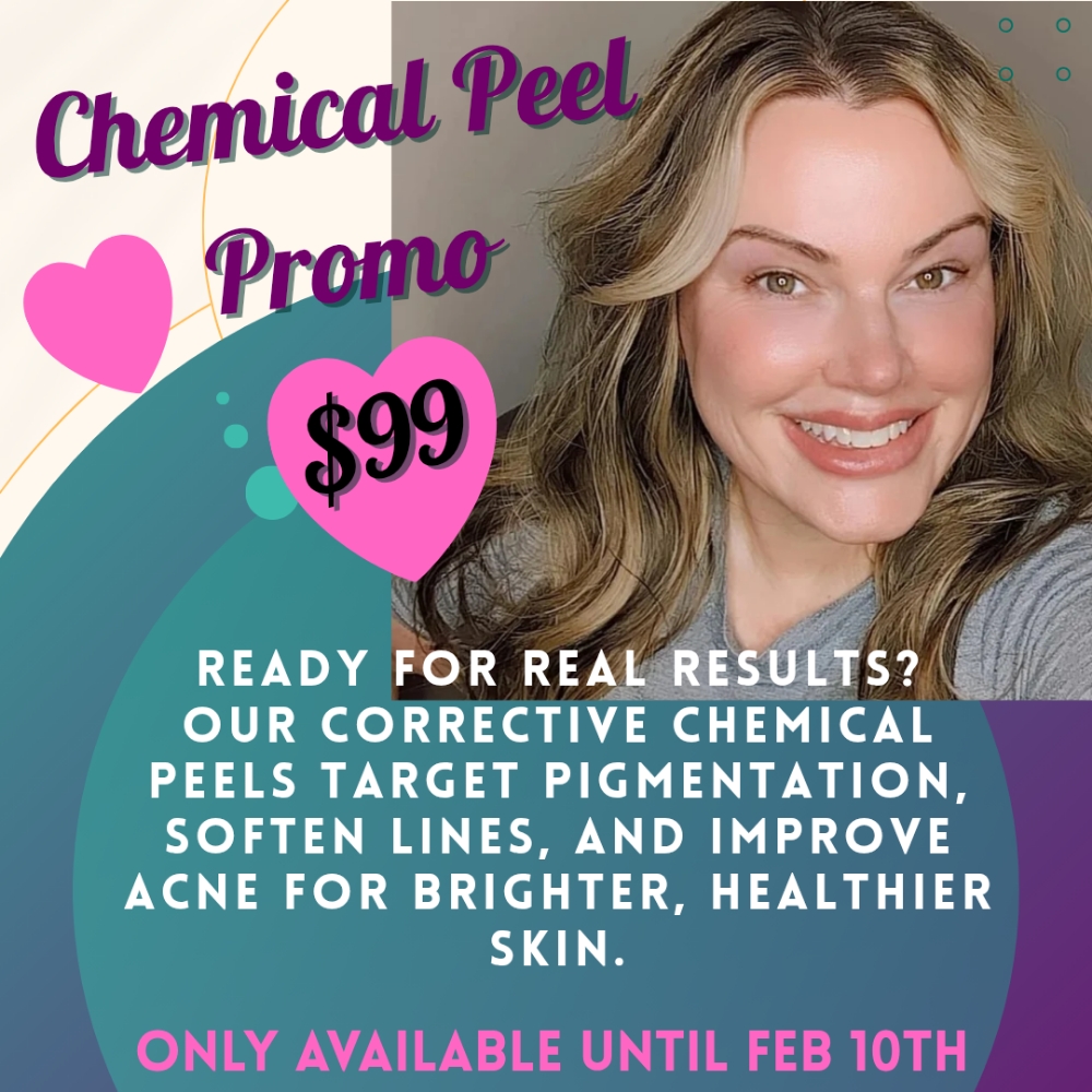 Peel Promo ONLY until FEB 10