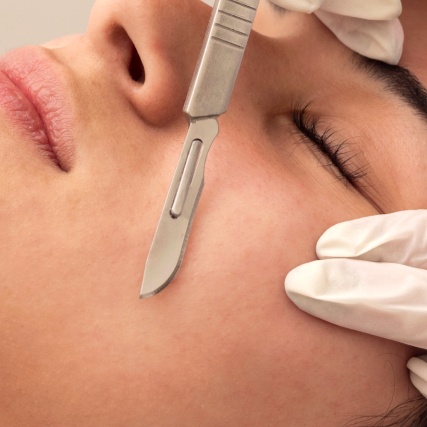 Velvet Skin Dermaplaning at Boss Skin Method in New Rochelle, NY