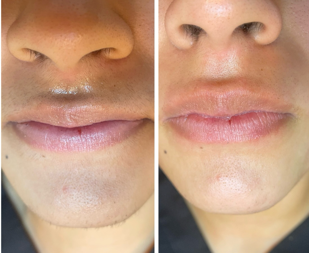 Lip Wax