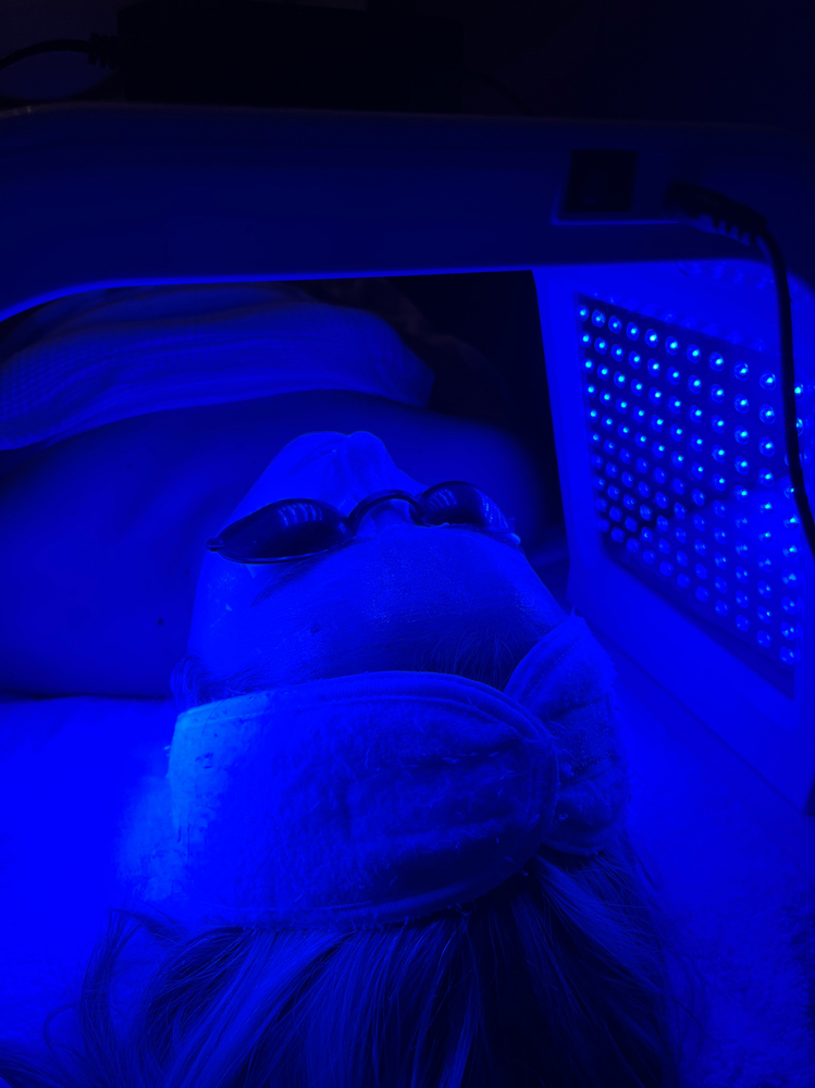 LED Light- ADD ON at Esthetics with Ali in Burleson, TX