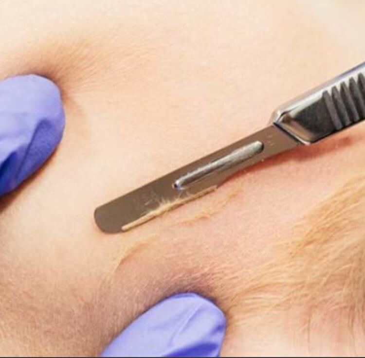 Dermaplane Express Facial at Zen Skin by Bee in La, LA