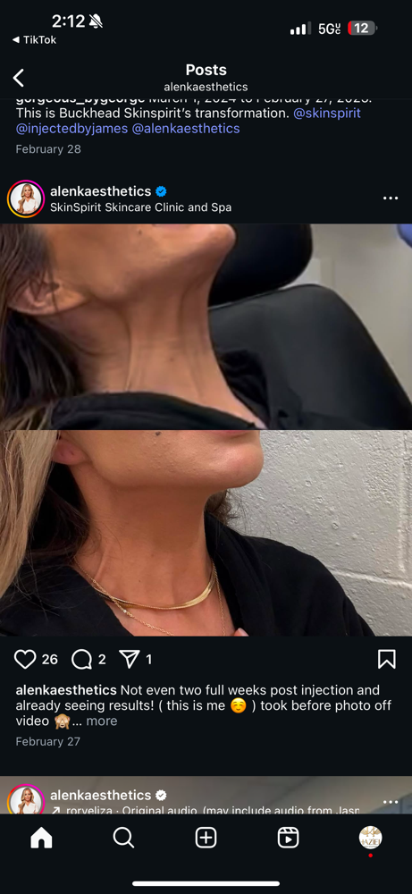 Morpheus 8 Neck Tightining boost