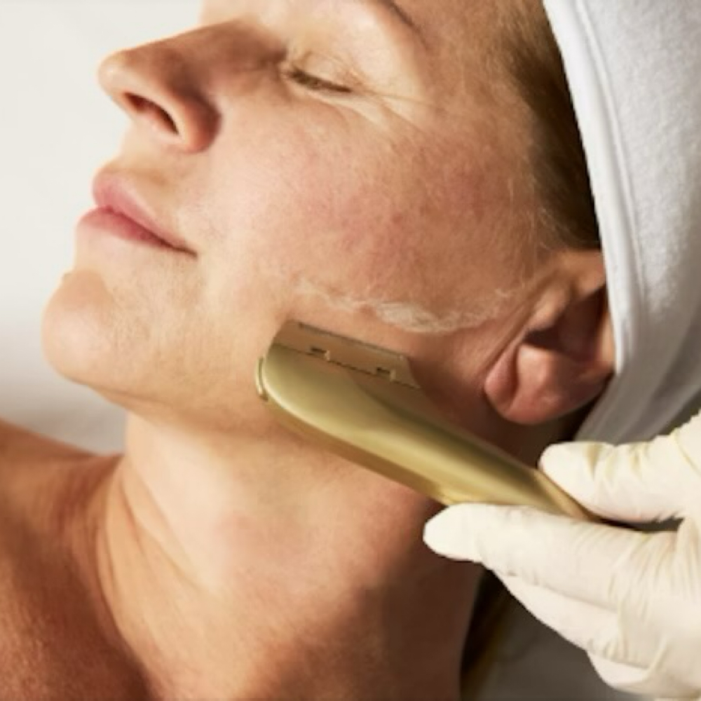 Dermaflash Facial (60min) at Salt + Light Skincare in Atascocita, TX