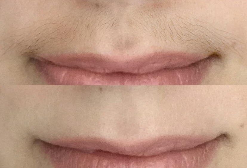 Lip