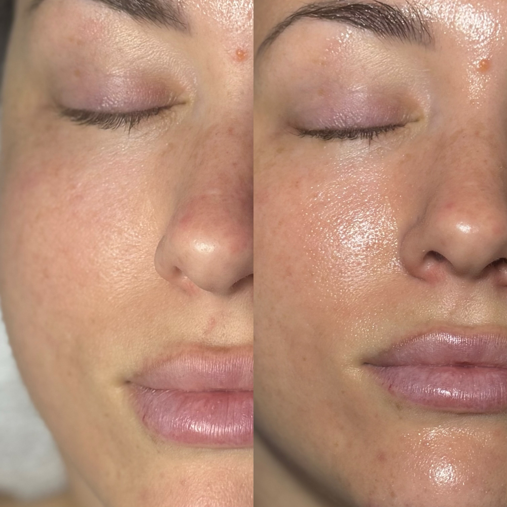 Timeless Signature Facial