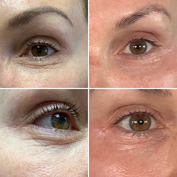 Brow Tint + Lash Lift (no Tint)