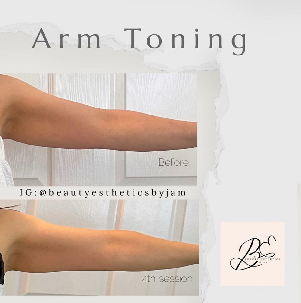 Sculpt & Tone Arms at Beauty & Esthetics By Jam in Henderson, NV