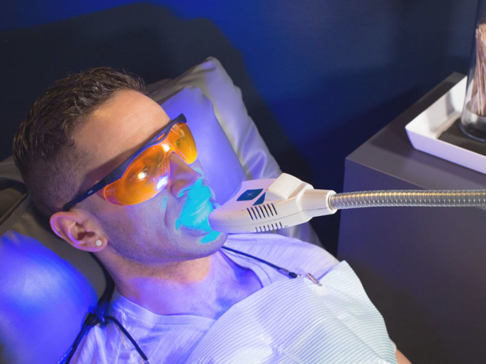 Teeth Whitening Short Session