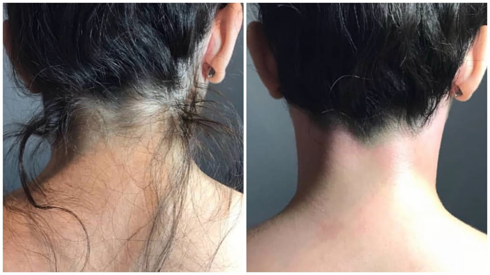 Neck