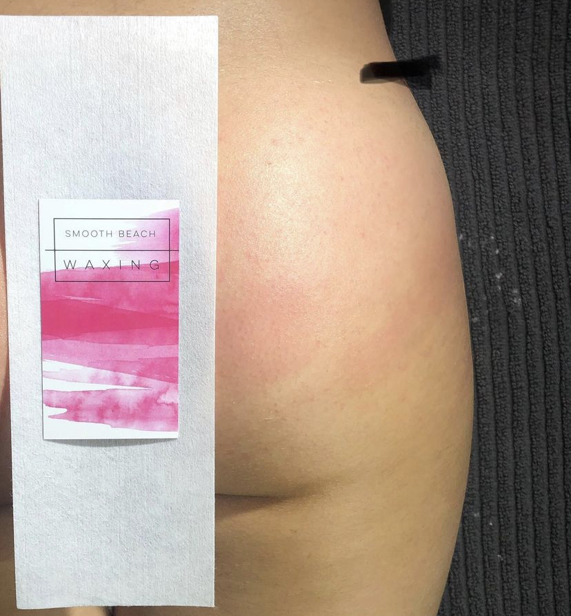 Full Buttocks