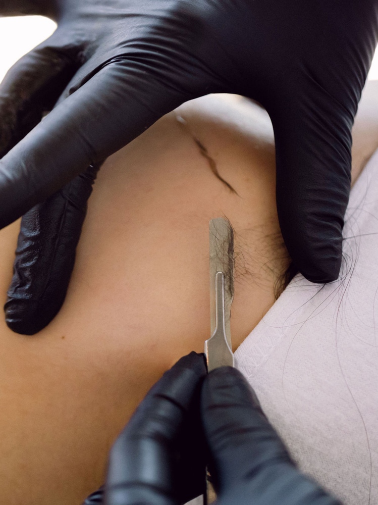 Dermaplaning **ADD-ON**