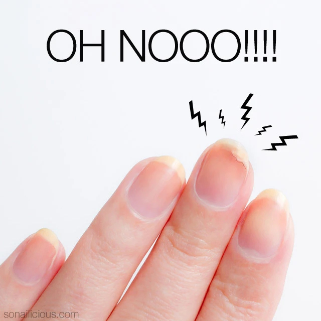 Nail Fix- Add On