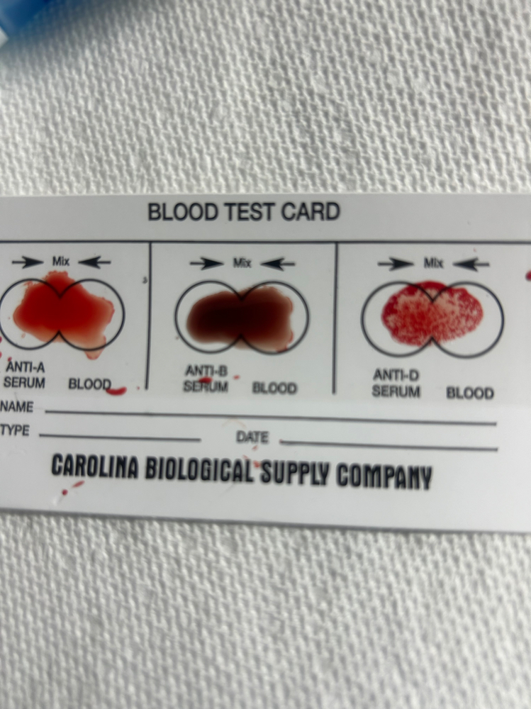 Rooted Type (Blood Typing) at Rooted Wellness Institute in Forest Park, GA