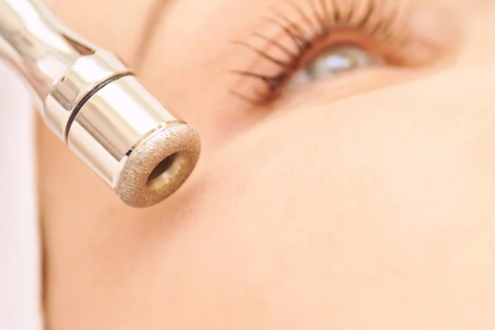 MICRODERMABRASION ADD ON