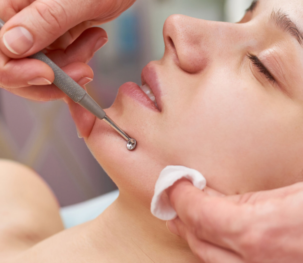 Extractions